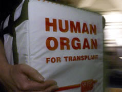 Kosove, EULEX konfirmon skandalin e transplantit te organeve ne Prishtine
