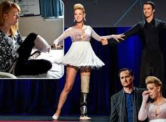 Humbi njeren kembe ne Maratonen e Bostonit, balerina rikthehet ne skene