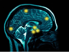 Njerezit e arsimuar sherohen me shpejt nga demtimet e trurit