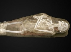 Teknologjia e re qe lejon autopsine e mumjes egjiptiane