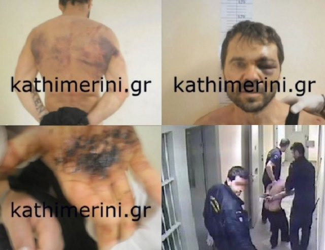 'Kathimerini' publikon video dhe foto te Kudret Kumes te torturuar (Video)